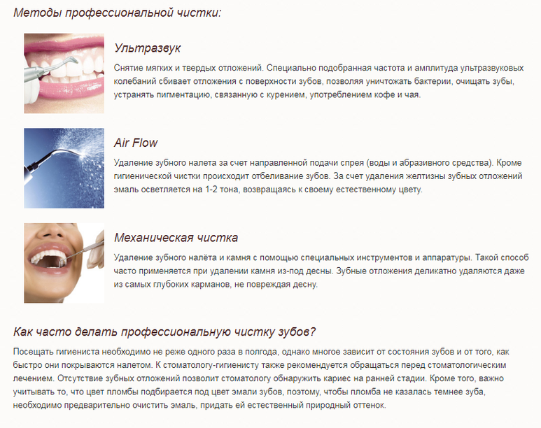 Как делают профессиональную чистку зубов?