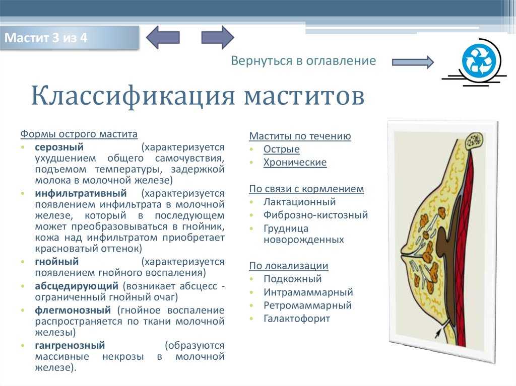 ᐈ лечение мастита (воспаления молочной железы) ~【киев】