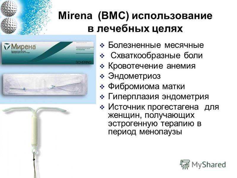 Введение внутриматочной спирали мирена : необходимая подготовка, показания, особенности и методика проведения | услуги клиники «проксима» (г. сочи)