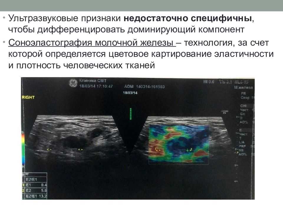 Какие заболевания выявляет маммография?
					- маммологический центр
					- лучевая диагностика
					- отделения
				- поликлиника на грохольском переулке
