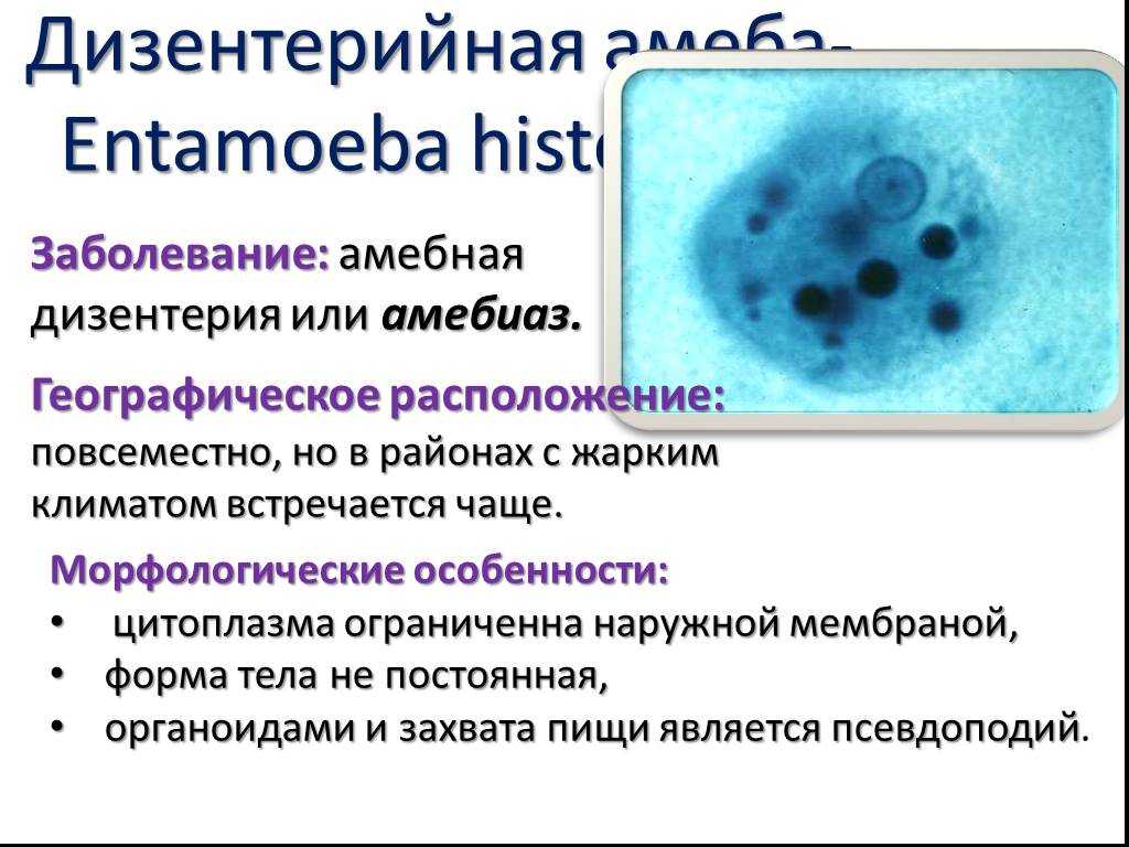 Амеба в ротовой полости, какие заболевания вызывает и как ее лечить