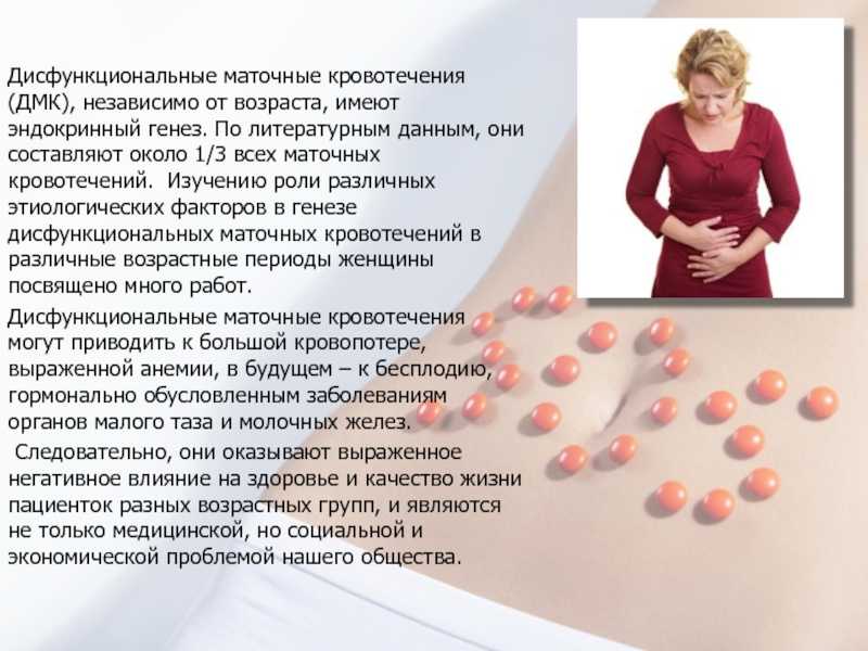 Дисфункциональные маточные кровотечения