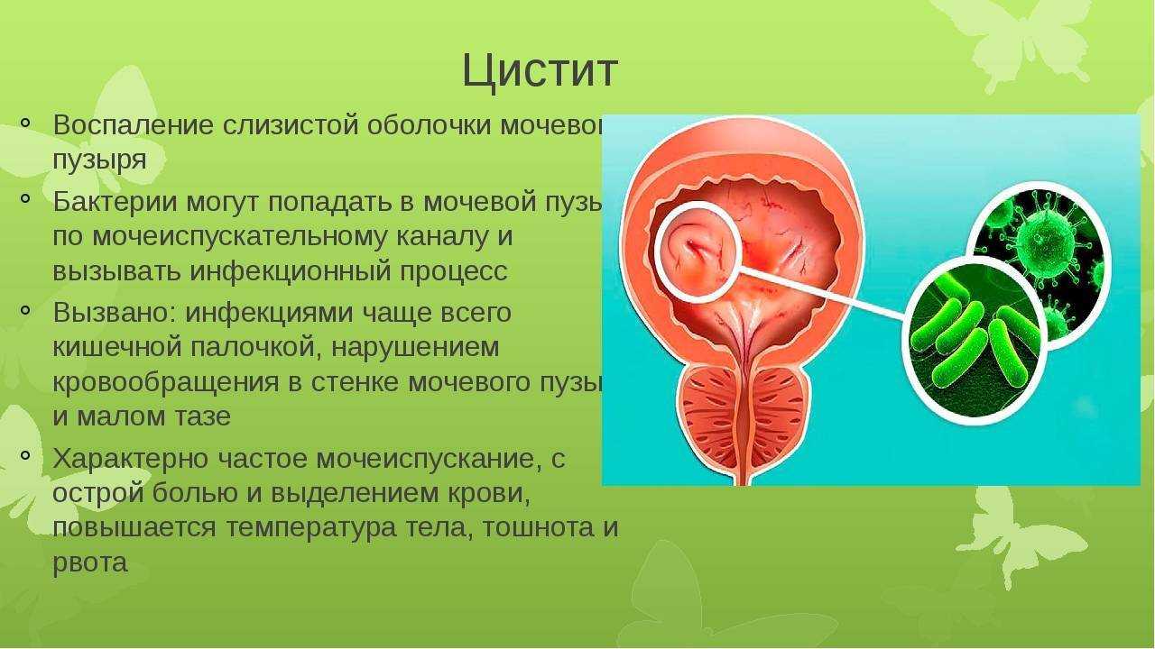 Воспаление мочевого пузыря лечение. Заболевания мочевыделительной системы цистит. Воспаление слизистой оболочки мочевого пузыря. Презентация на тему цистит. Заболевание выделительной системы почек.