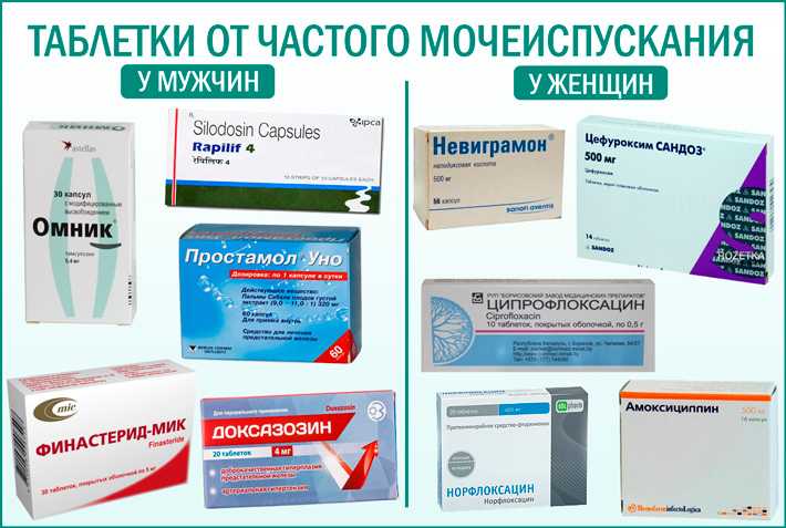 Цистит у мужчин - симптомы и признаки. диагностика и лечение в нии им. н.а. лопаткина.