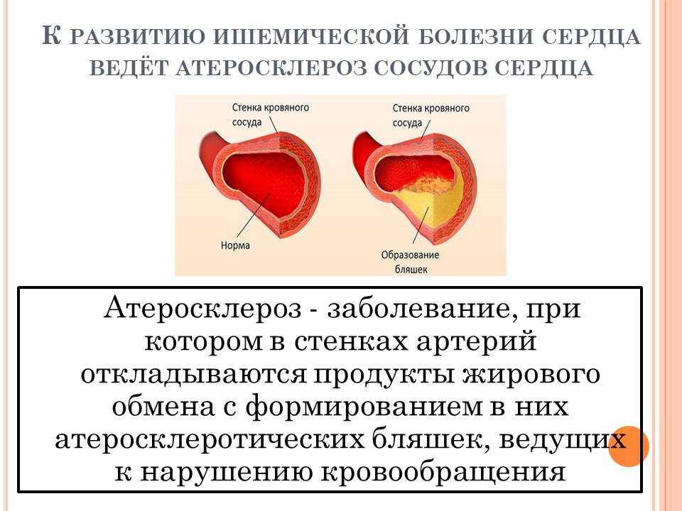 Какие бывают основные признаки инфаркта? первая помощь при инфаркте?