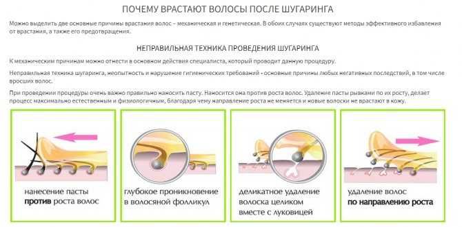 Лечение вросших волос * клиника диана в санкт-петербурге