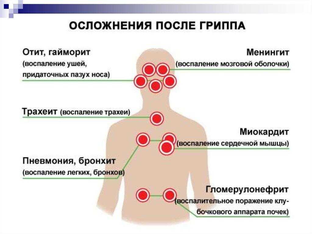 Профилактика гриппа и орви у детей: методы, препараты, памятка