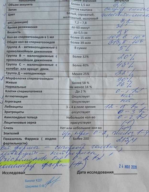 Спермограмма: главный анализ при мужском бесплодии