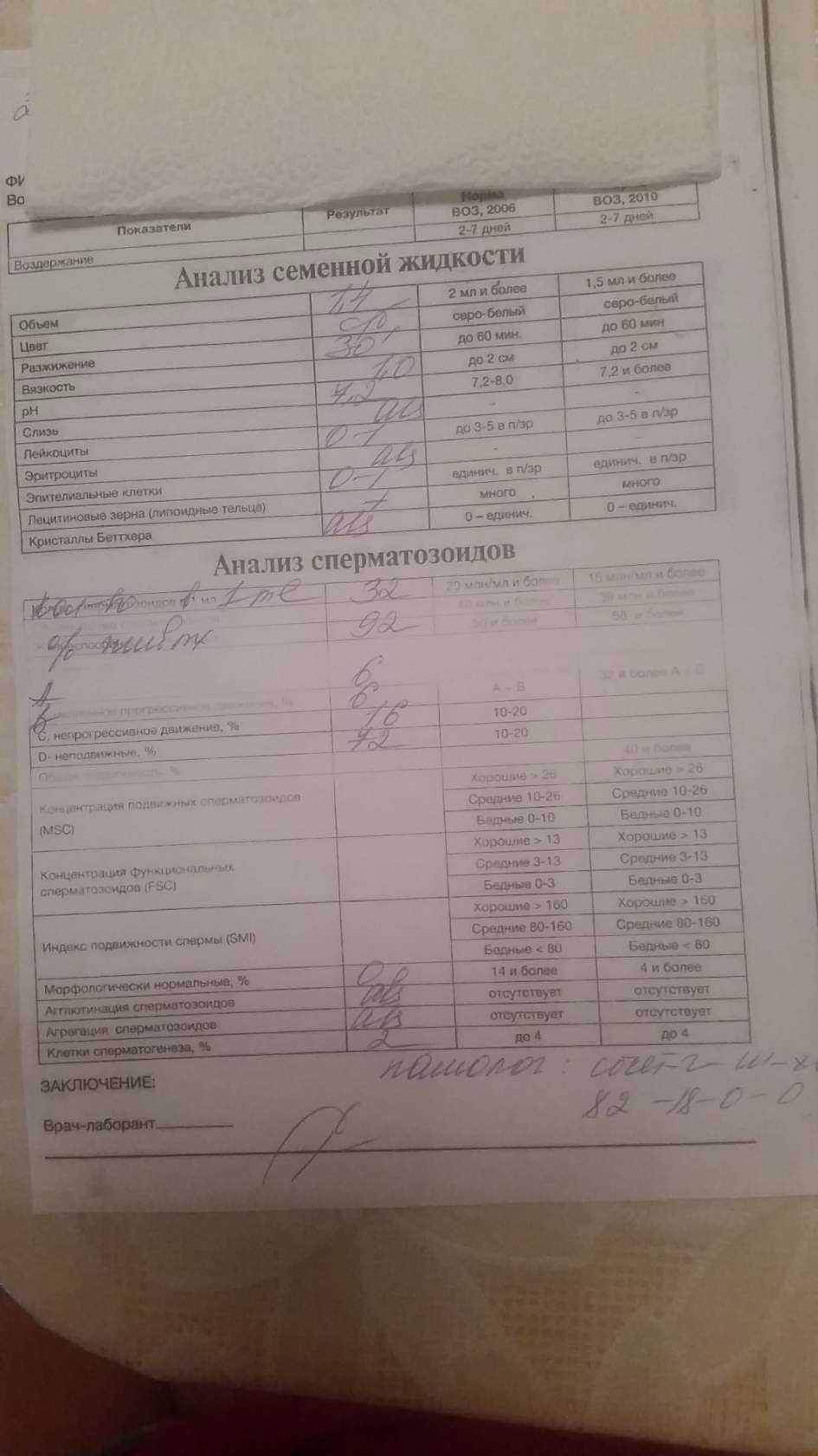 Анализ на ревматоидный фактор