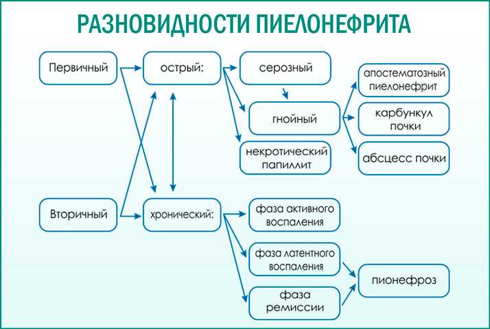 Как лечить цистит у женщин?