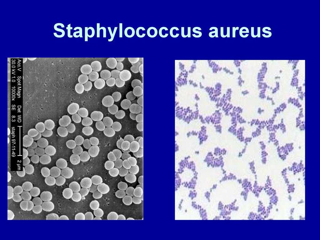 1 staphylococcus aureus. S. aureus золотистый стафилококк. Стафилококки генцианвиолет. Золотистый стафилококк микроскопия. Золотистый стафилококк микробиология препарат.