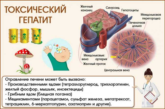 Алкогольный гепатит