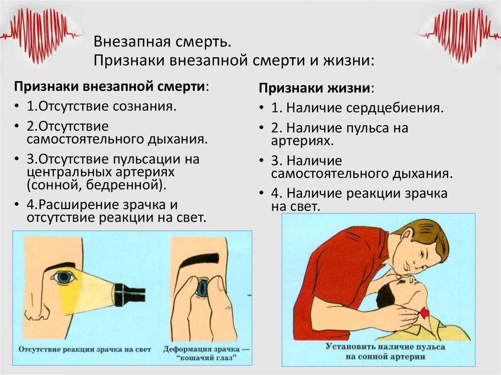 Обморок: виды, причины, симптомы и первая помощь