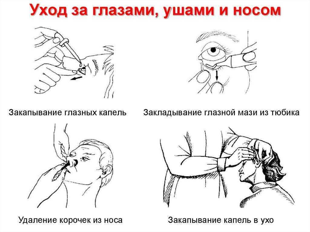 Удаление серной пробки