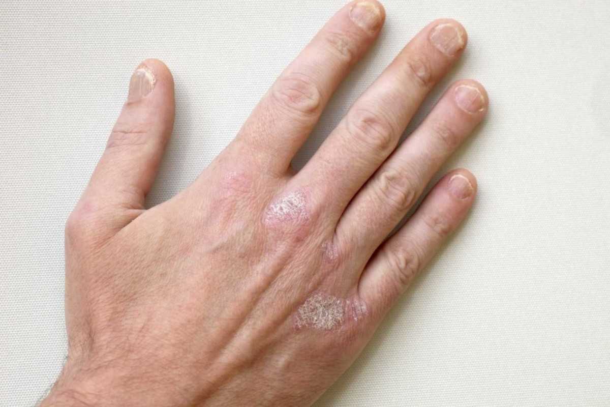 Забота о коже зимой: средства по уходу за кожей лица и рук