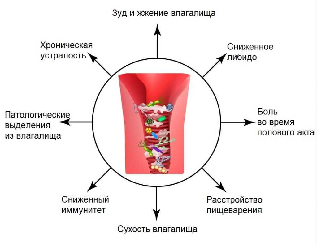 Кандидозный баланит – баланопостит у мужчин