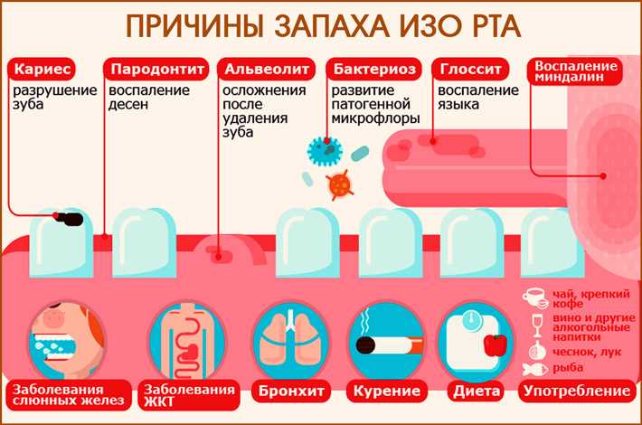 Неприятный запах изо рта * клиника диана в санкт-петербурге
