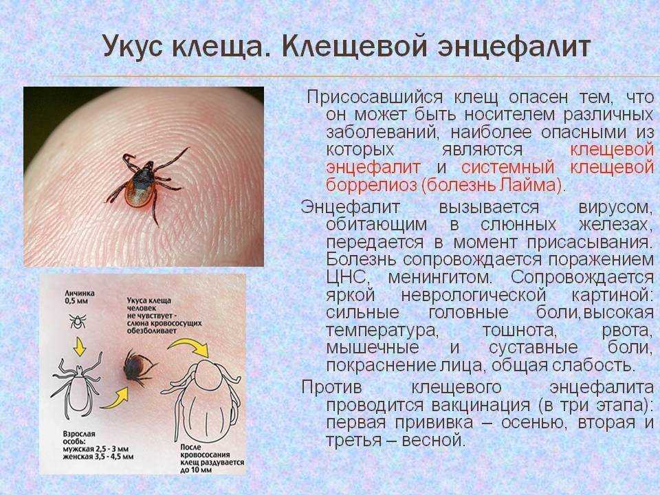Чесотка: симптомы и лечение, как выглядит (фото) – эл клиника