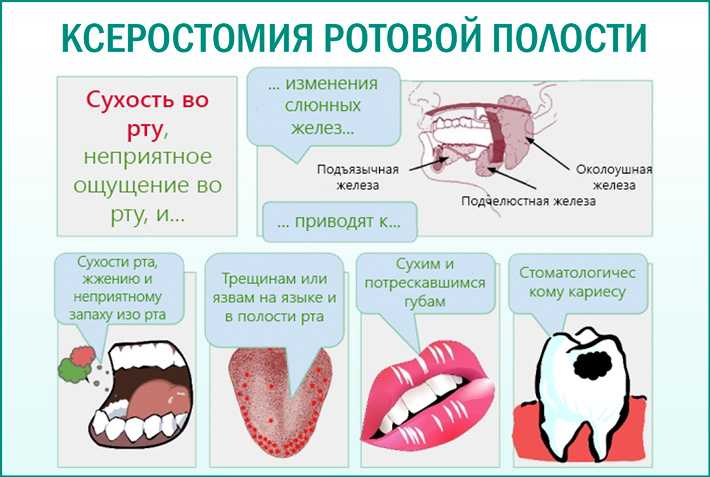 Привкус во рту: горький, металлический, кислый, соленый. причины, лечение - стоматология блеск новосибирск