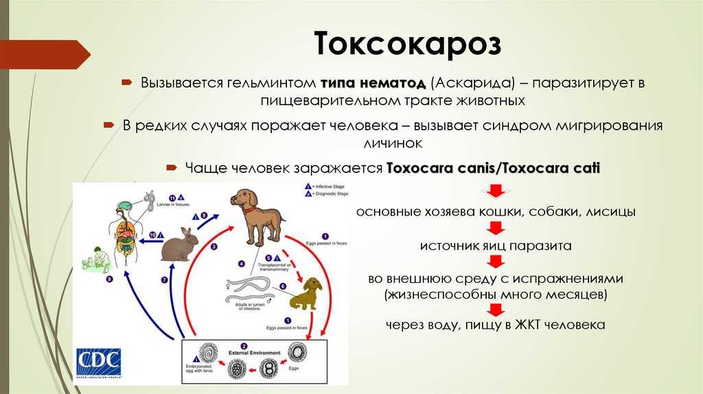 Токсокароз