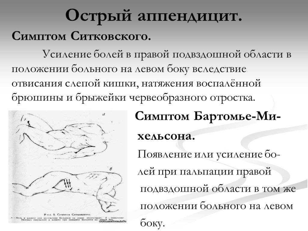 О реальных причинах аппендицита рассказывает гастроэнтеролог сергей вялов | читайте в журнале столетник