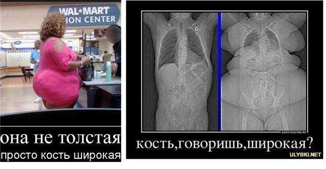 Переломы костей: общие сведения | eurolab | травматология