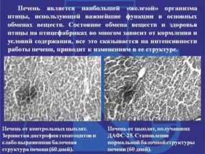 Структура печени: неоднородная, мелко и крупнозернистая