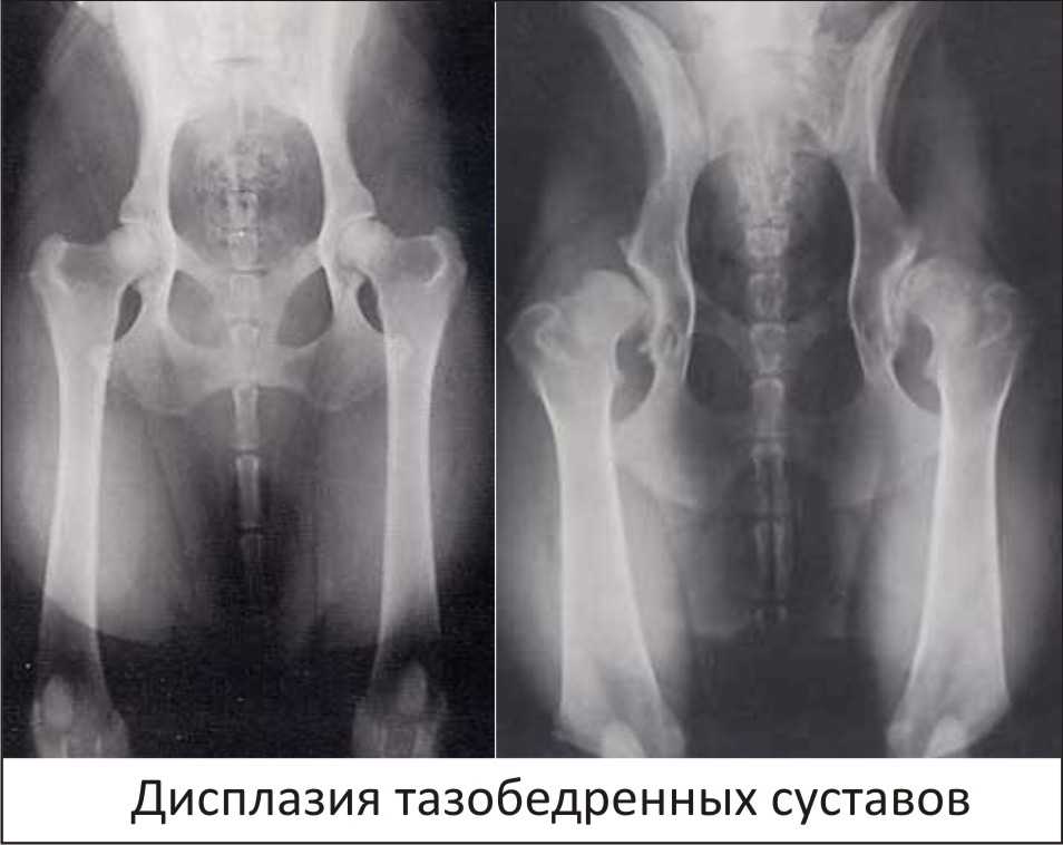 Что такое дисплазия и как она проявляется. причины и симптомы заболевания