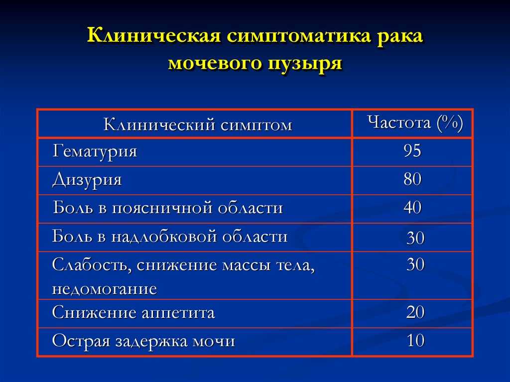 Рак мочевого пузыря - причины, симптомы, диагностика, прогноз