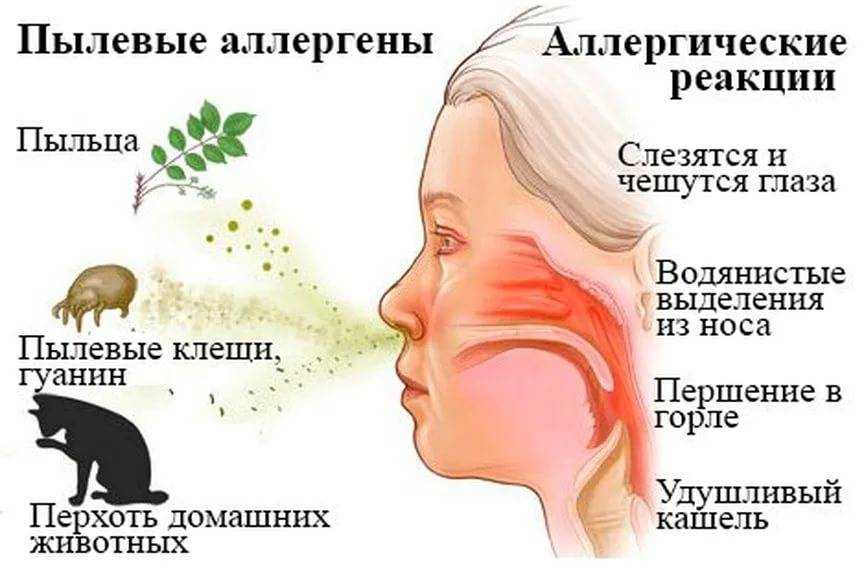 Аллергия (не) лечится — публикации семейной клиники детство плюс