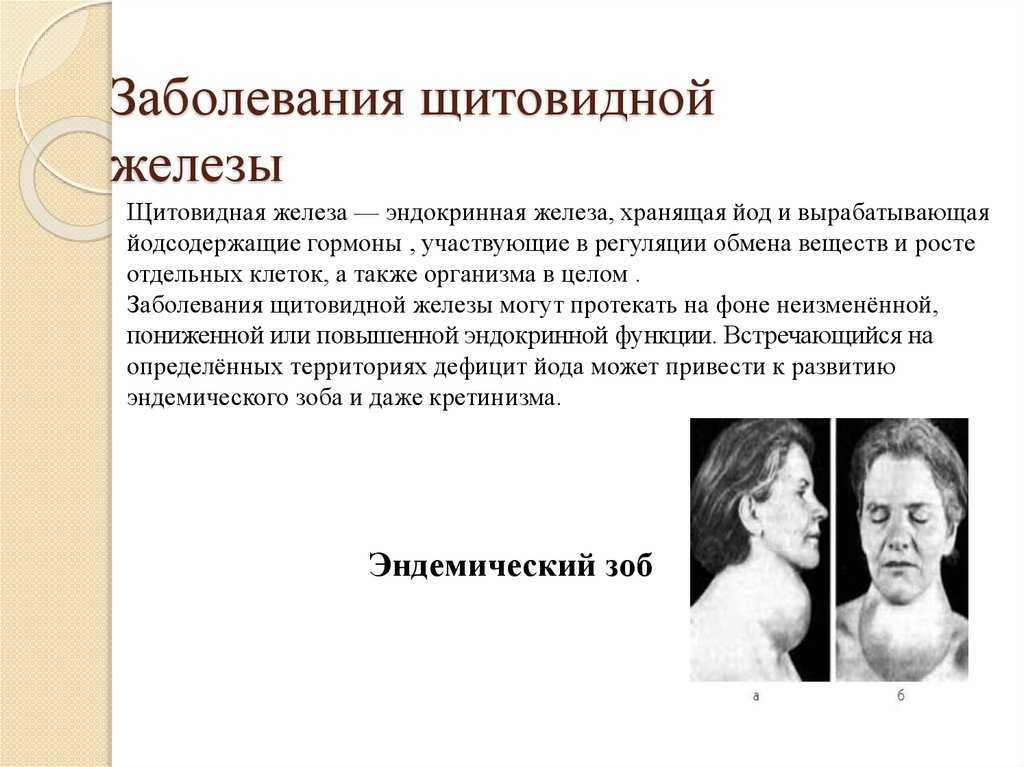 Все о щитовидной железе – заболевания, симптомы и лечение | статьи медицинского центра «см-клиника»