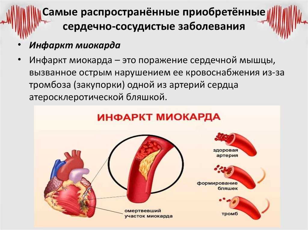 Как сохранить сердце пожилого человека гбуз вфд г.копейск