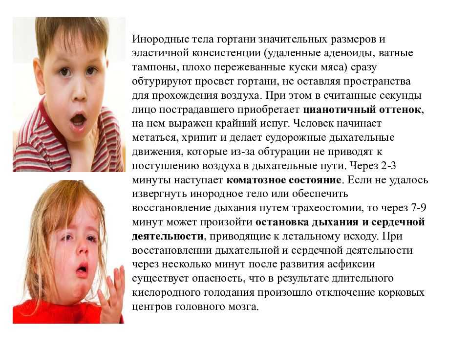 Рыбная кость в горле: симптомы и способы удаления!