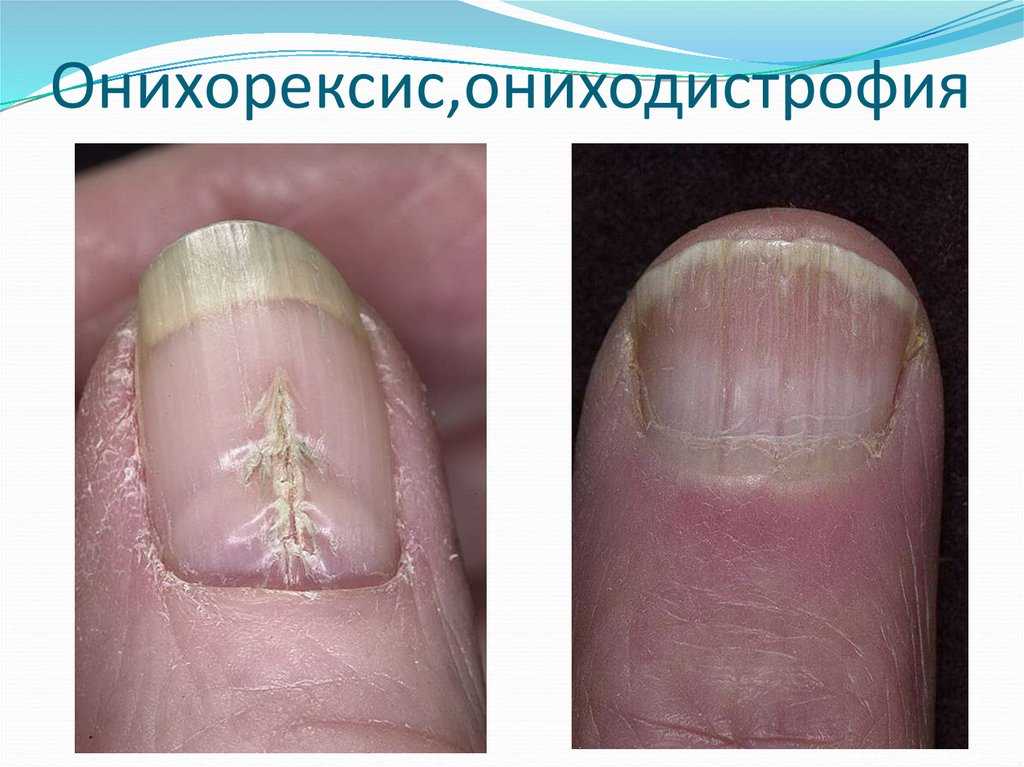 Коричневые пятна на ногах - пигментация кожи - флеболог суханов