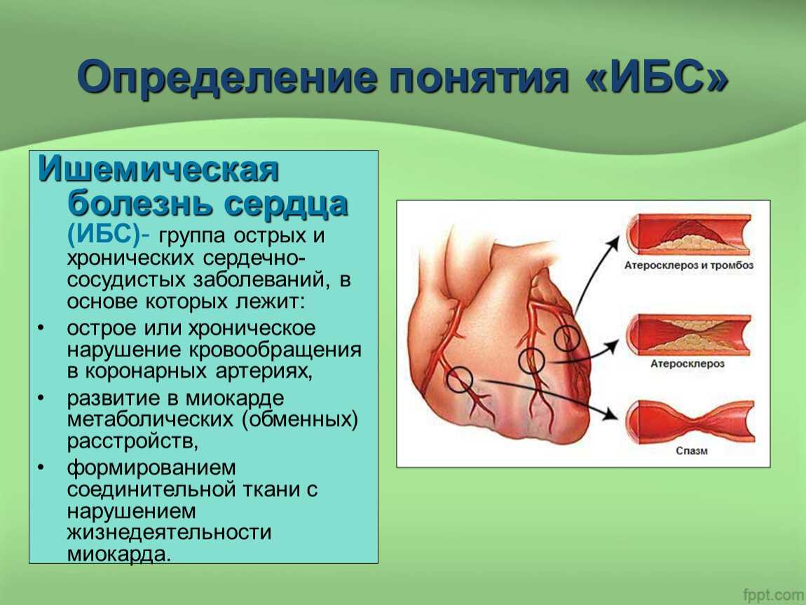 Формы и факторы риска развития ибс. ишемическая болезнь сердца: методы диагностики, симптомы и лечение