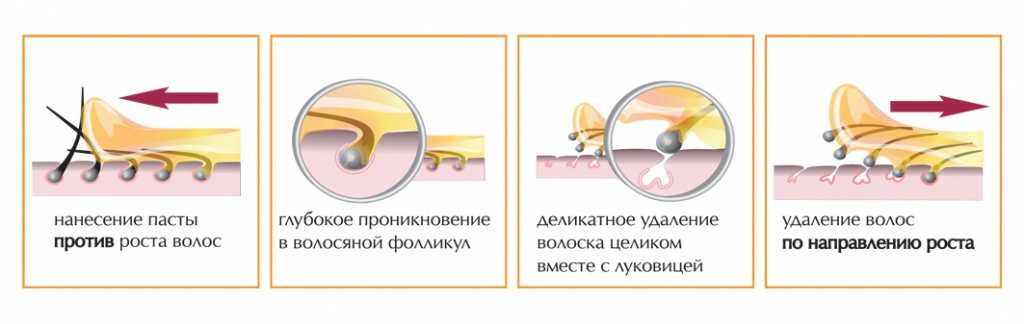 Как проводится восковая депиляция?