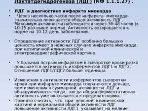 Лдг общая
