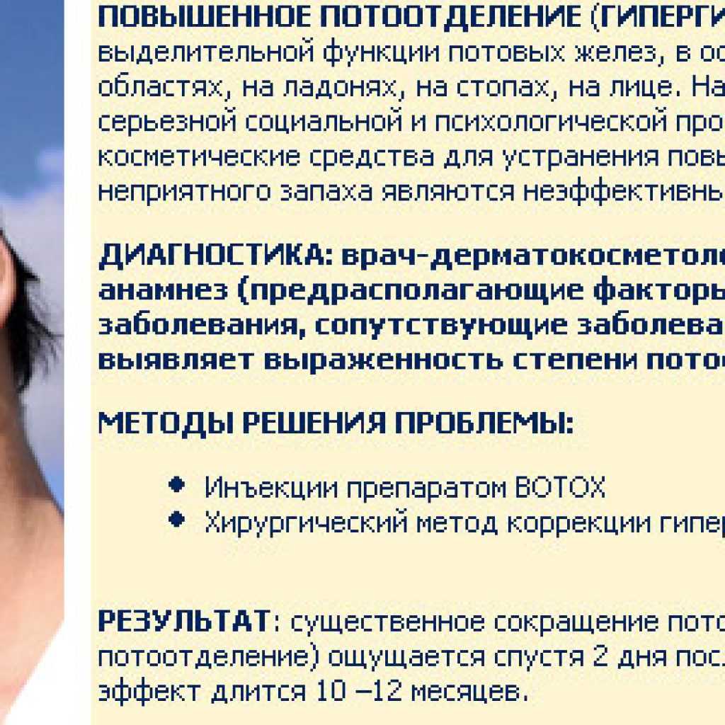 Гипергидроз у детей: почему возникает это заболевание, чем грозит и как его лечить?
