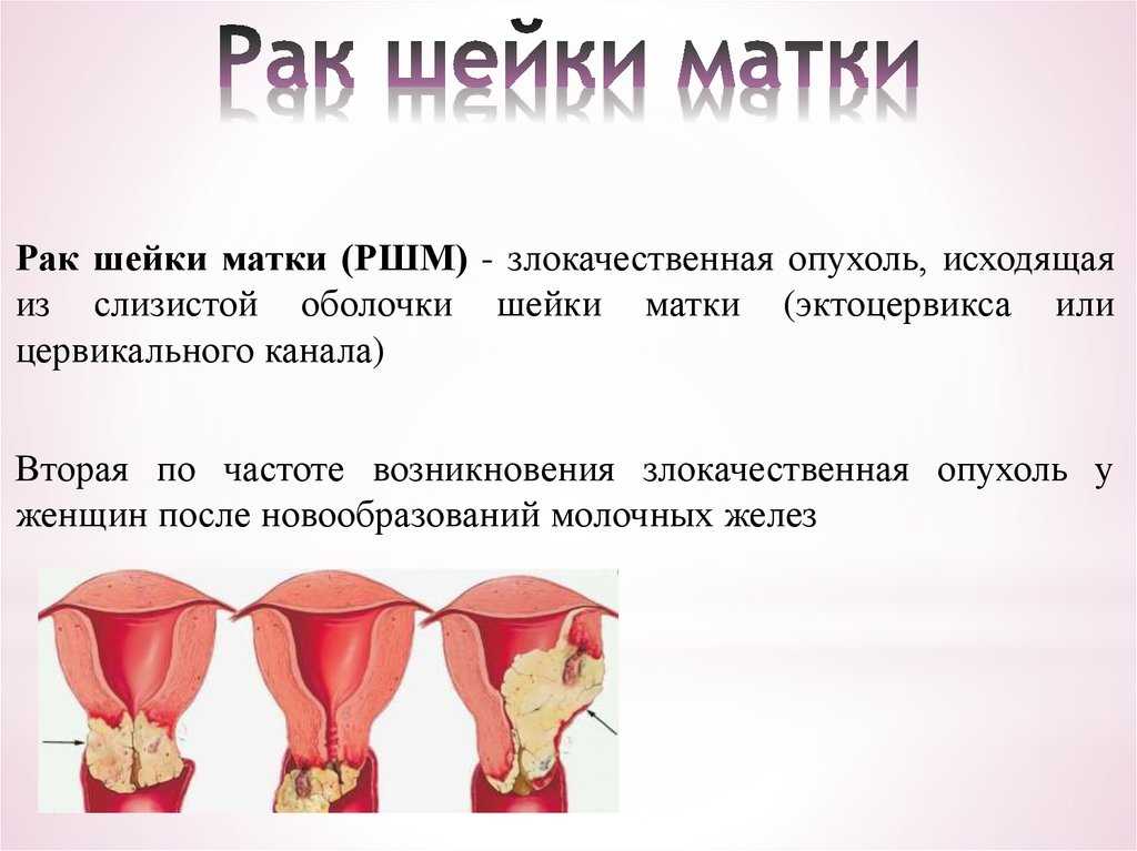 Общие рекомендации в период сокращения матки после родов