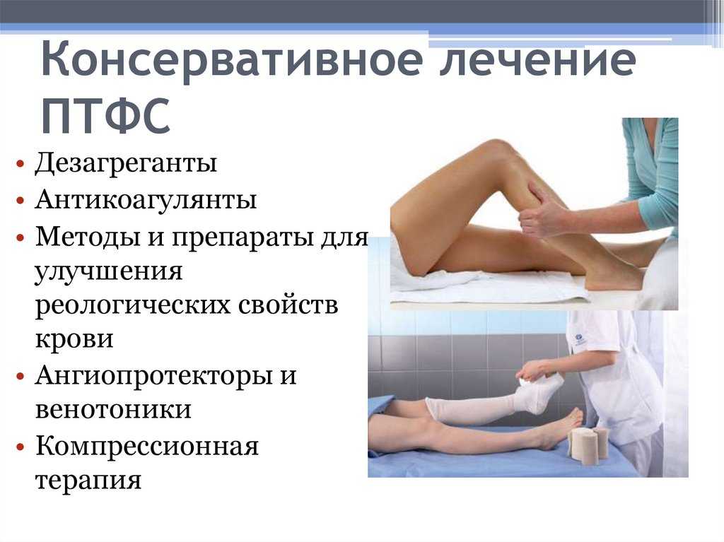 Тромбы