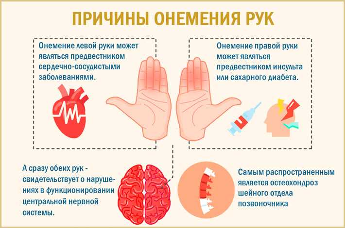 Почему на руке немеет мизинец, и безымянный - доктор позвонков