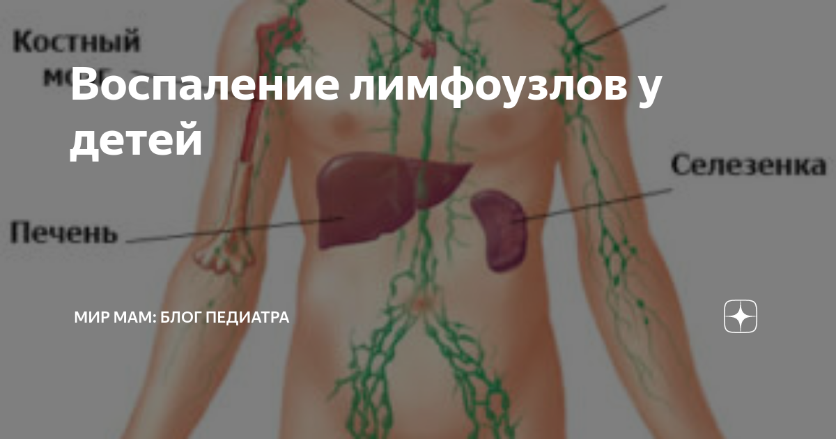 Увеличенные лимфоузлы (лимфаденопатия)