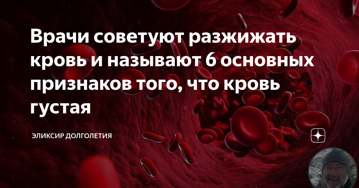 Сканирование крови, густая кровь и причины повышения вязкости крови