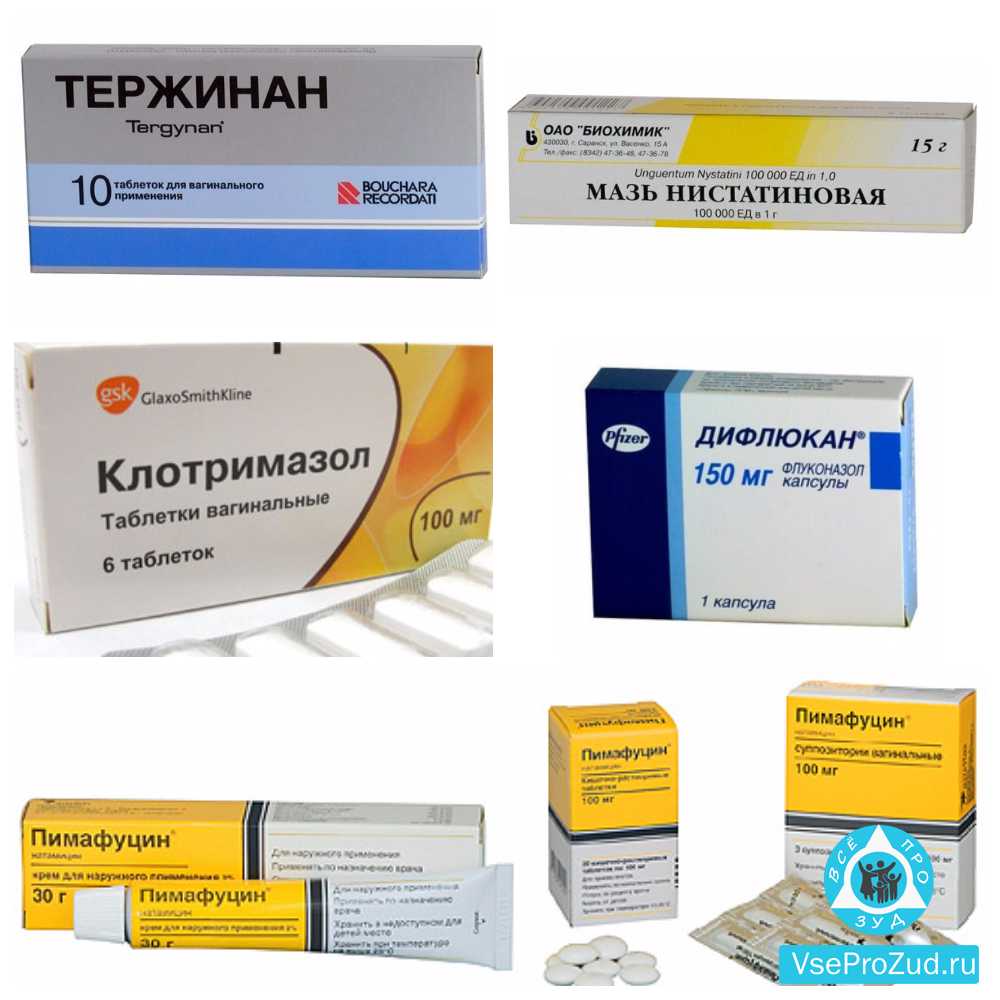 Выделения из половых путей