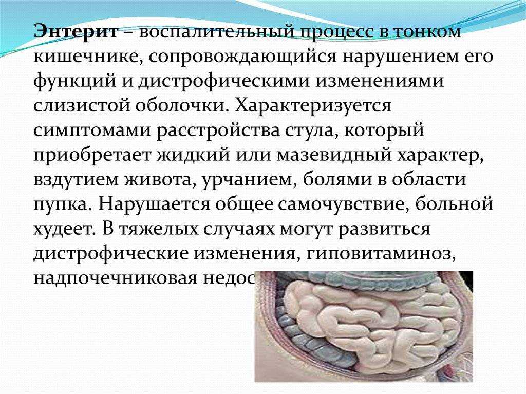Энтероколит кишечника у взрослых и детей: симптомы и лечение - санаторий «электра»