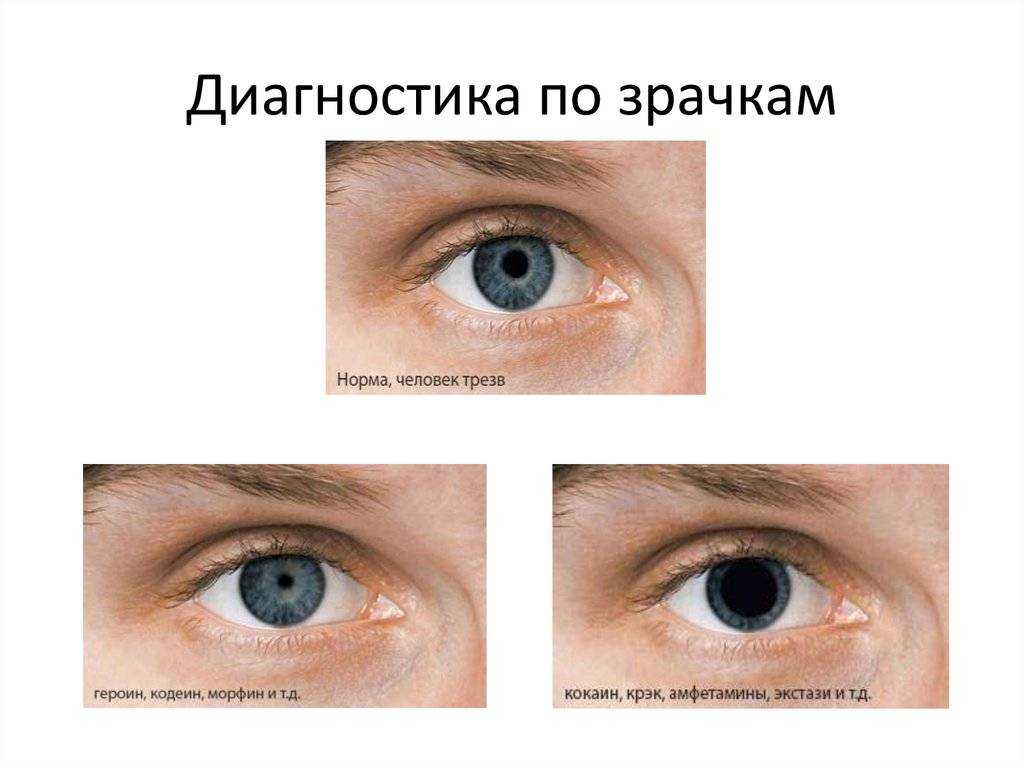 Зрачки как зеркало души: определение психологического состояния по расширению или сужению зрачков