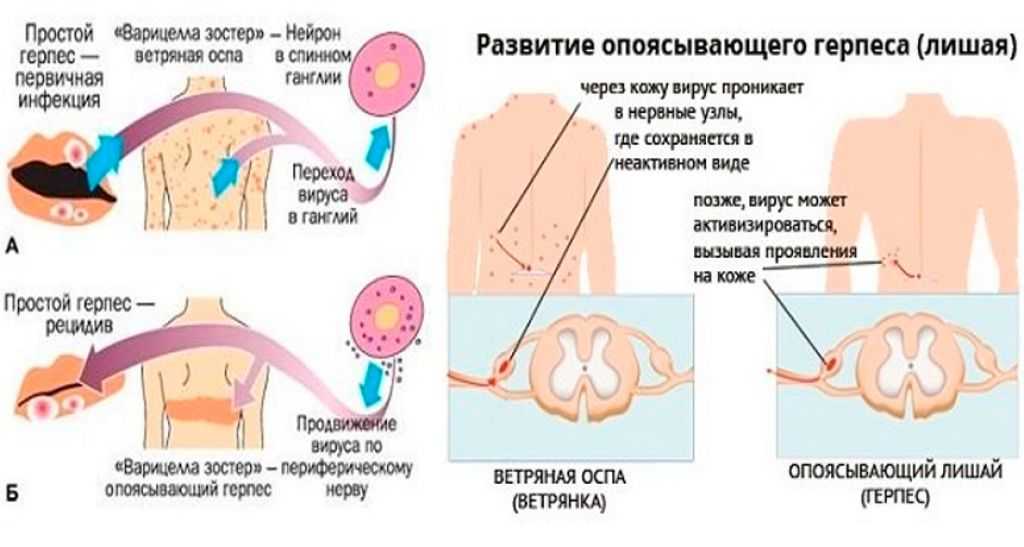 Герпес на губах —  витагерпавак