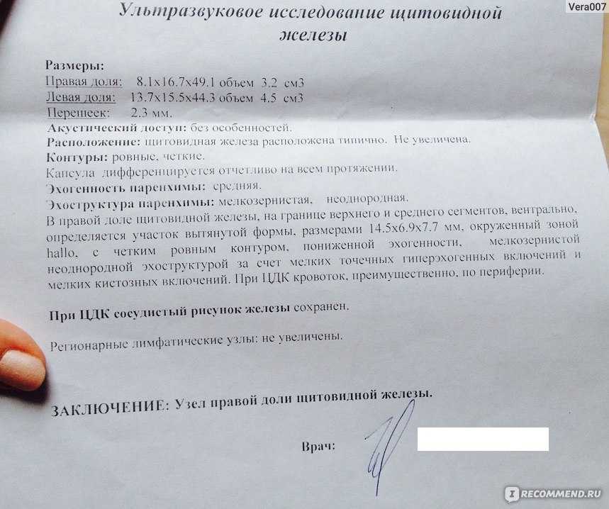 Операции при раке щитовидной железы