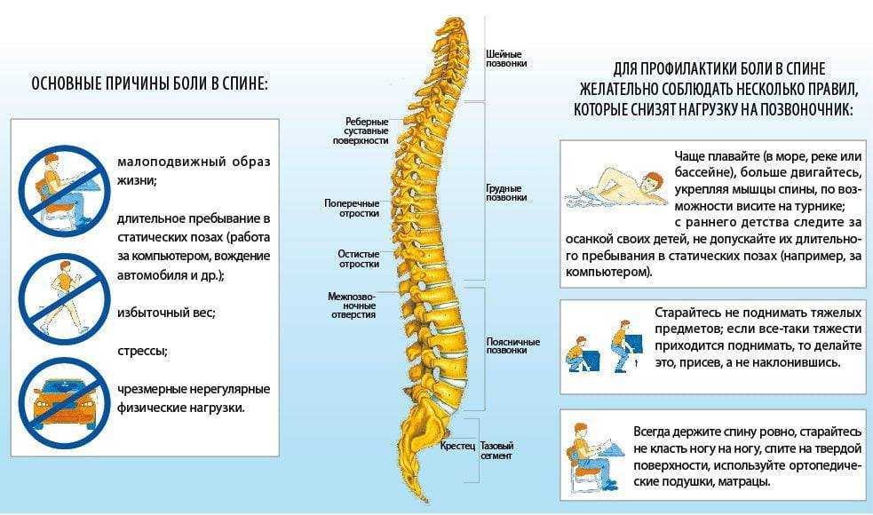 Боль в пояснице: причины и лечение сильных поясничных болей