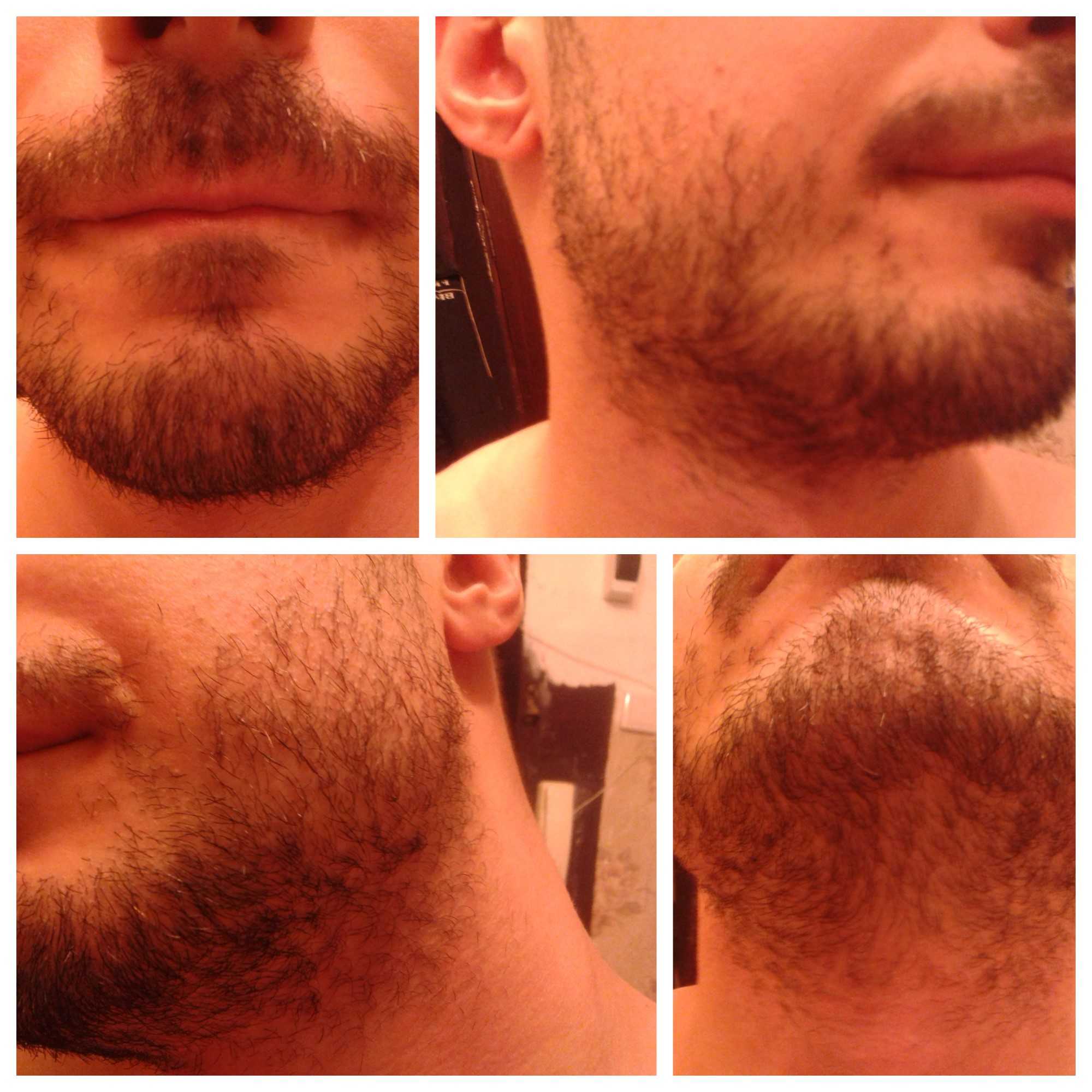 Рост волос на лице у мужчин. Миноксидил для бороды. Heavy Beard миноксидил. Миноксидил для бороды Прогресс. Миноксидил 5 % alerana для бороды.